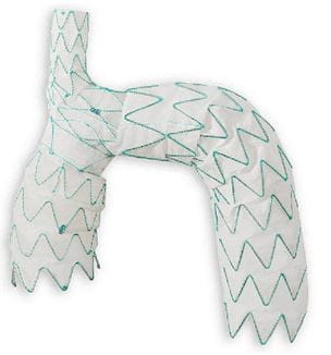 Aortic arch stent device