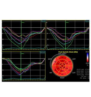 Cardiovascular novel markers