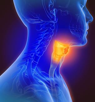 Neck cancer illustration