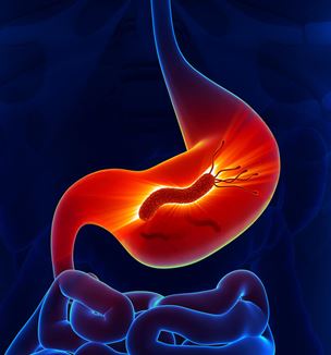 Heliobactor pylori in stomach illustration