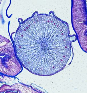 Ovarian tissue scan