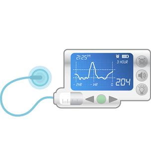 Getty image of insulin pump