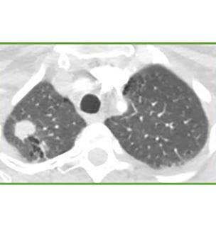Radiology image