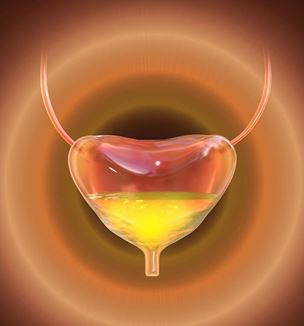 Overactive bladder illustration