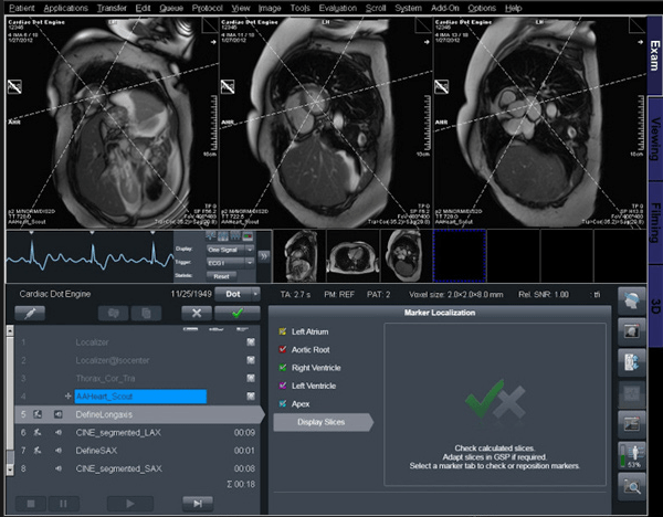 Advanceded-Intervential-Cardiovascular-Center