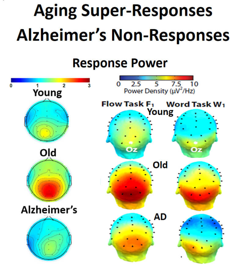 Dr. Duffy’s research on aging and Alzheimer’s disease has shown increased brain power use in aging that precedes the loss of power with the development of impairments in Alzheimer’s disease.