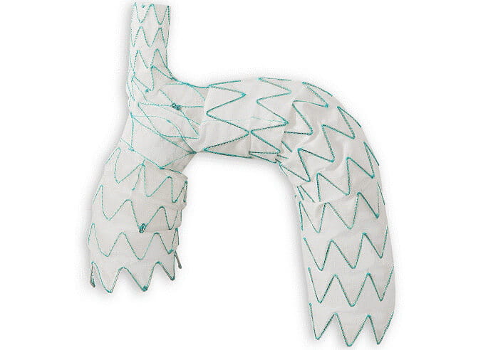 Aortic arch stent device