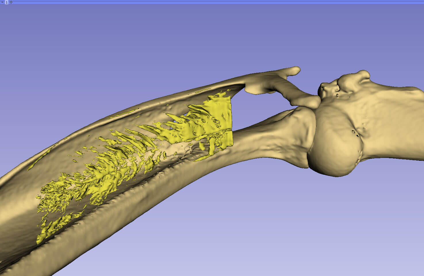 Tendon Repair Image 1