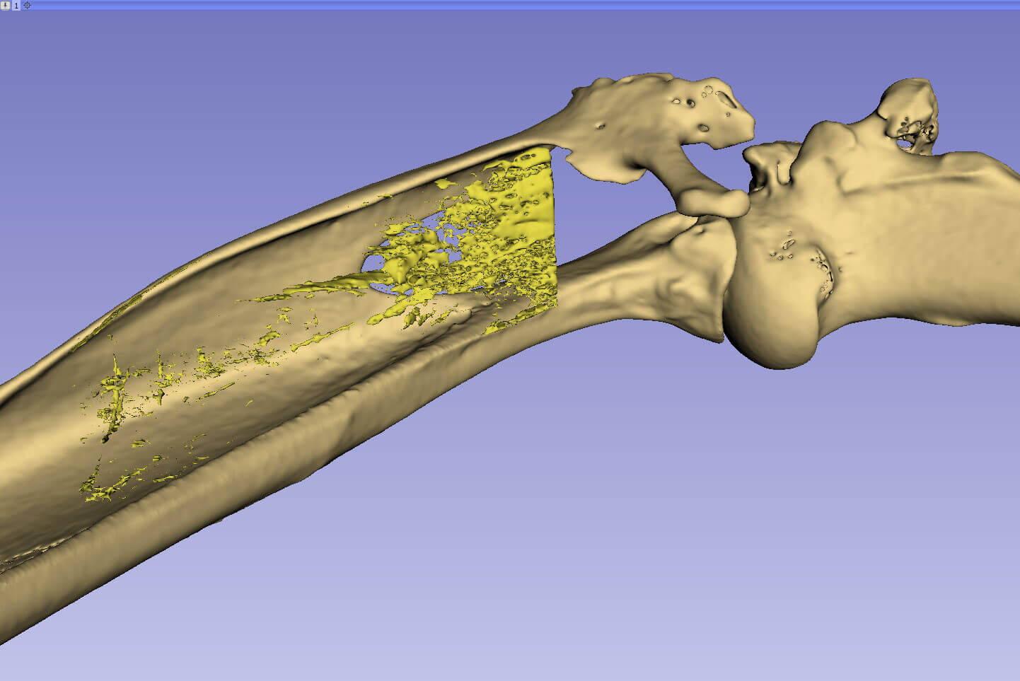 Tendon Repair Image 2