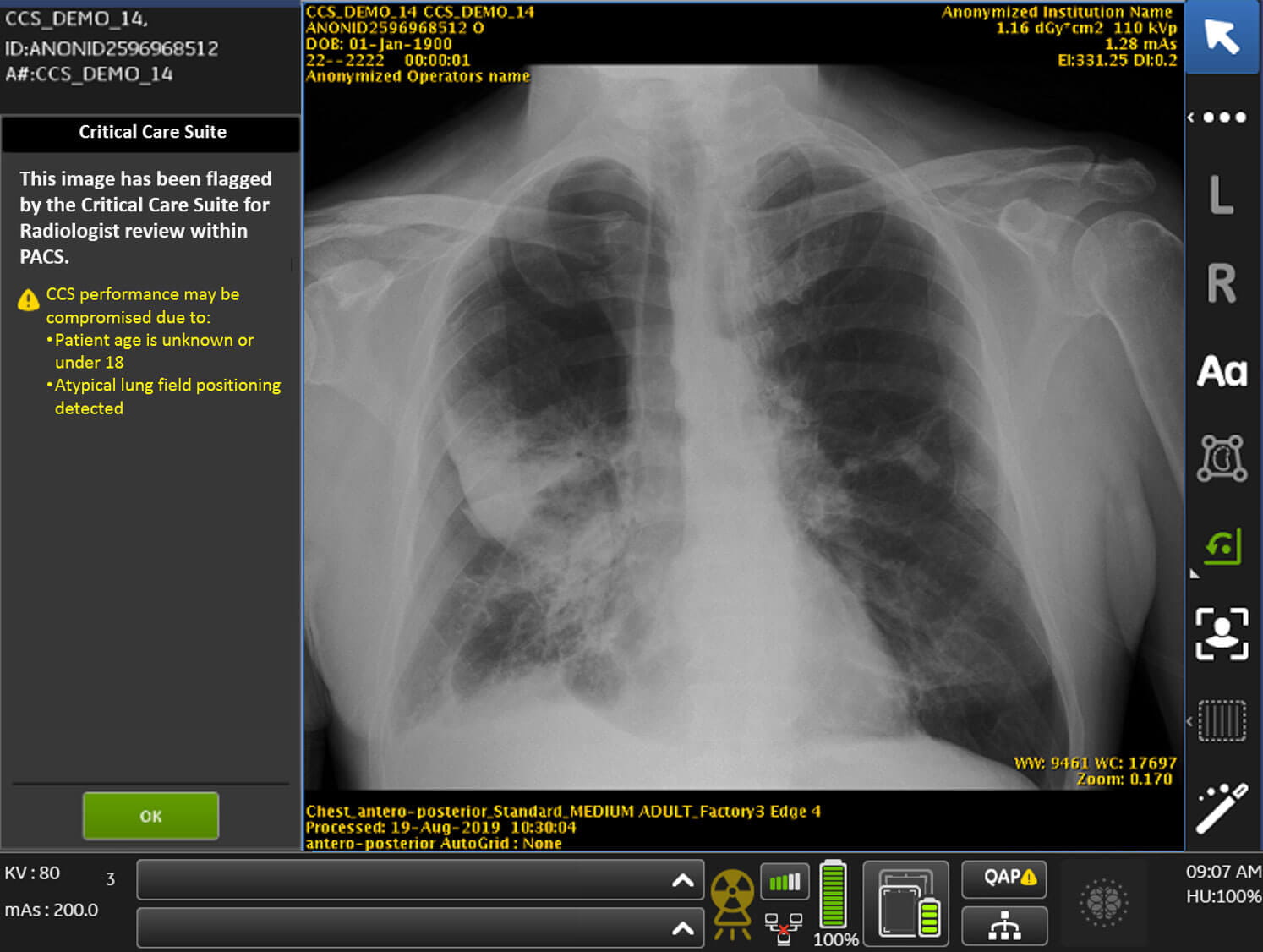 Critical Care Suite Interface