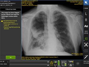 Chest scan