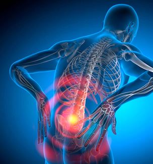 Getty image of lower back pain illustration