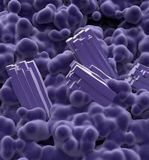 Getty image illustrating crystal formation in chronic kidney disease