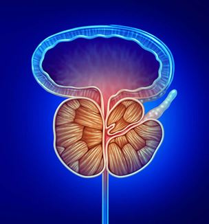Getty image illustration depicting enlarged prostate