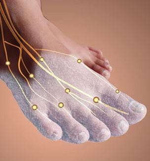 Getty images of foot with neuropathy