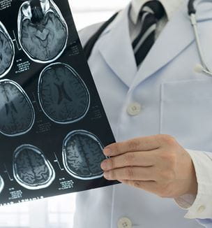 Getty image of physician examining brain scan