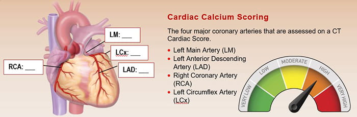 Calcium scoring illustration