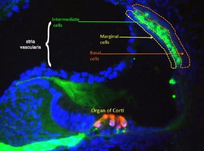 Stria Vascularis image