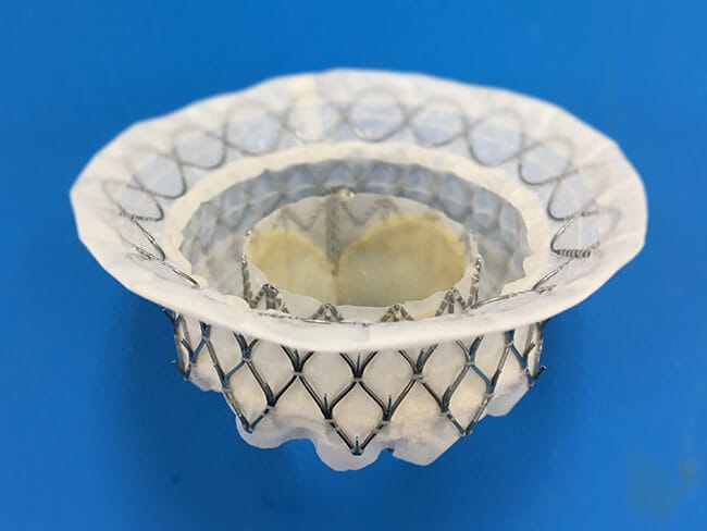 MitraClip device