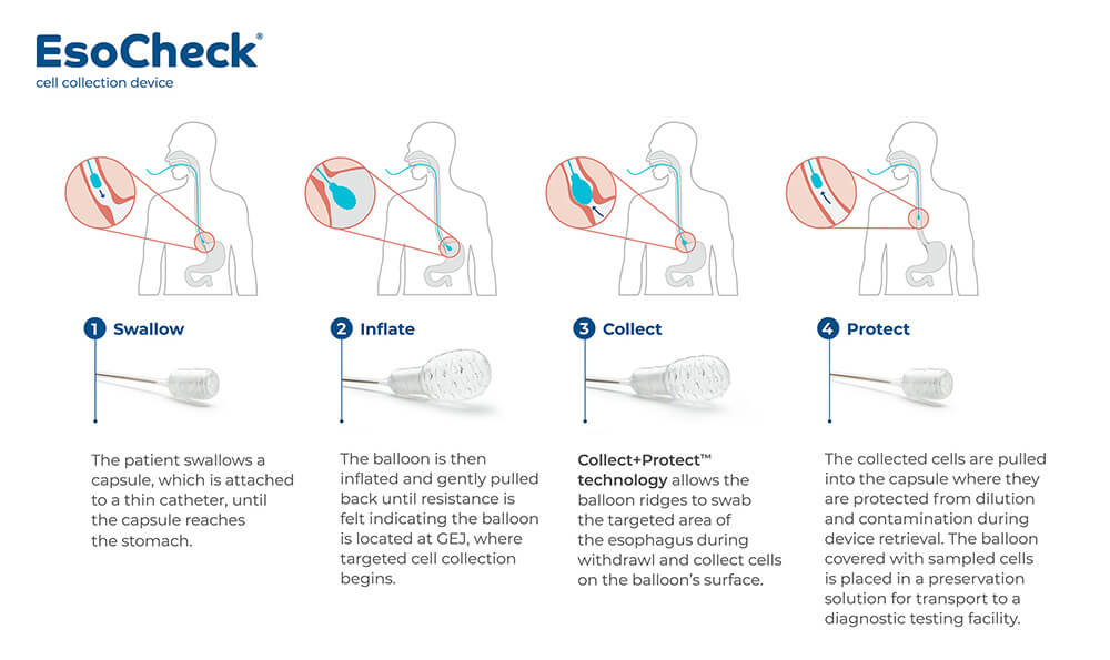Esocheck procedure chart