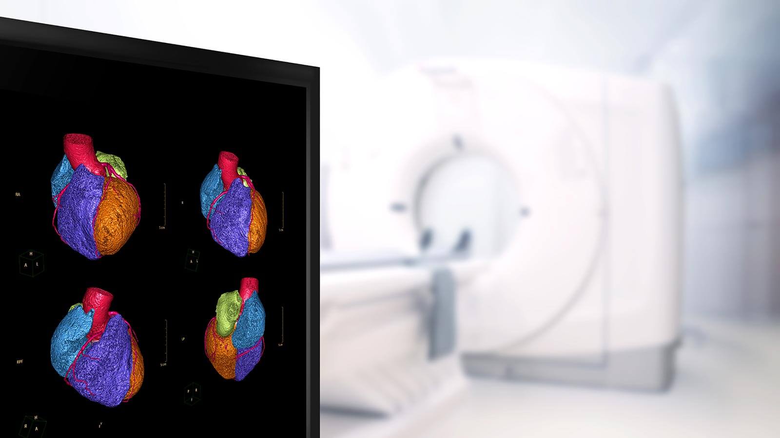 Cardiac CT