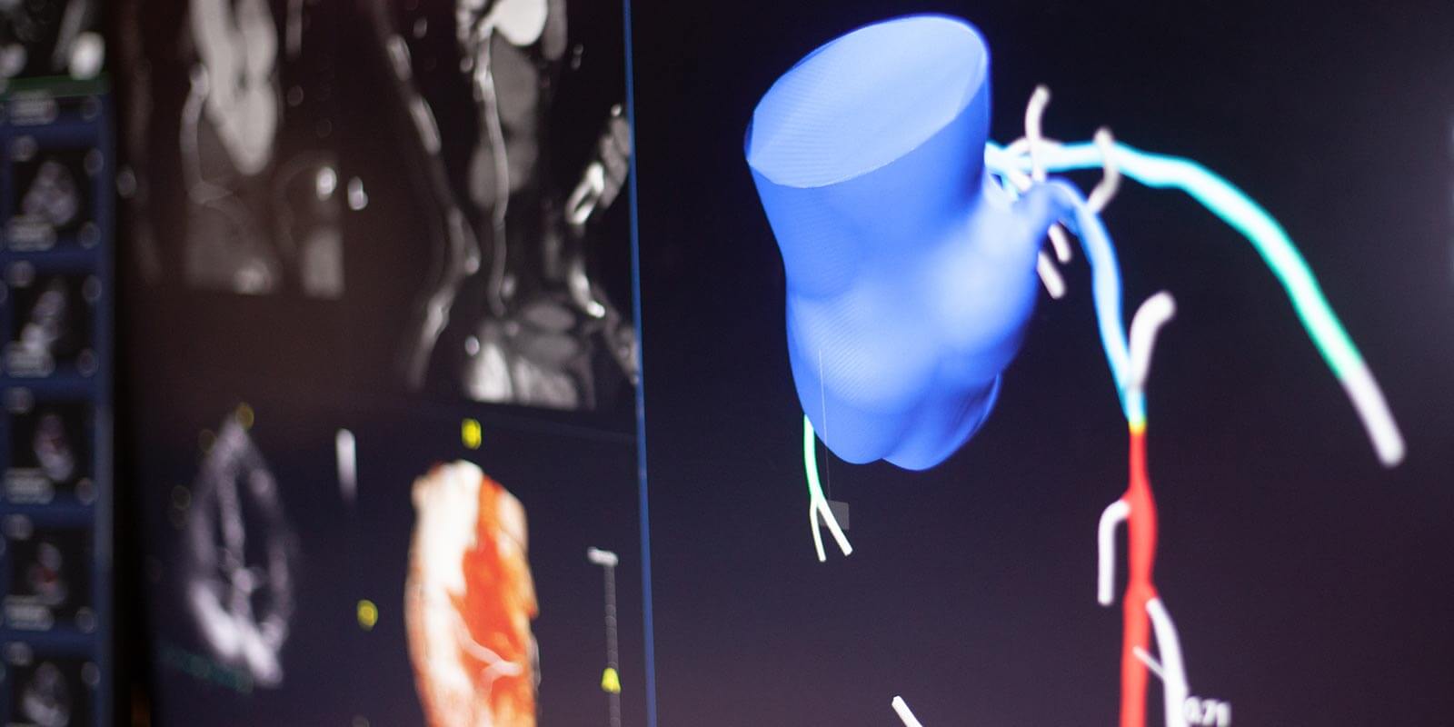 heart imaging