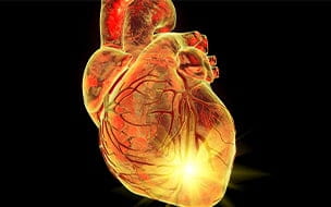 Conceptual illustration of a heart attack