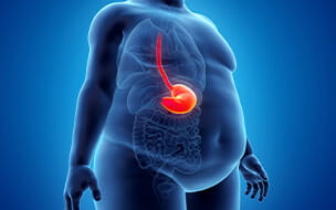 Illustration of an obese man's stomach