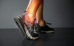 Illustration of ankle injury and joint pain