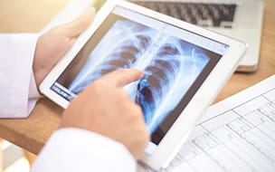 Lung Nodules - Facts About These Common Growths and How They're Treated