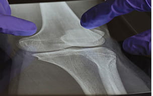 Innovations in Orthopedic Surgery in 2021: What’s new and what’s proven