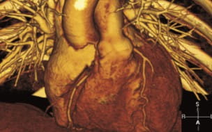 Safe Cardiovascular Testing During COVID-19