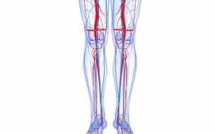 Treatment of Venous Disease Including Care During COVID-19