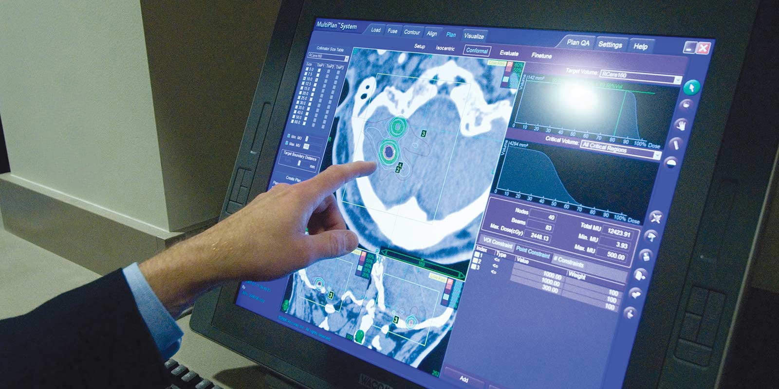Medical staff reviewing patient brain scan.