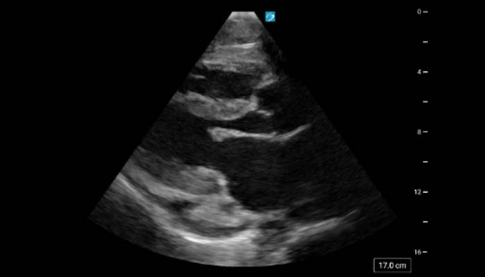 POCUS