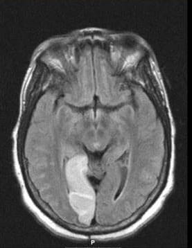 Neuroradiology and PACS Neuroimaging