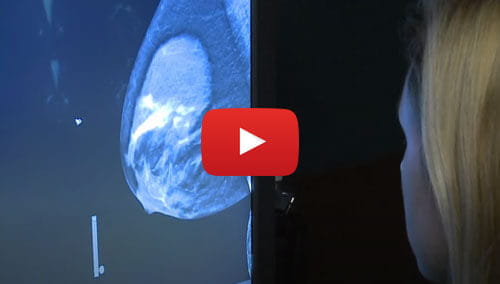 2D vs. 3D Mammography