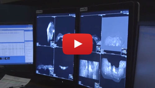 Breast Screening Technology