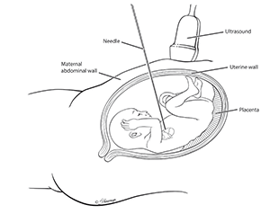 birthing diagram