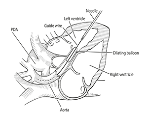 heart diagram