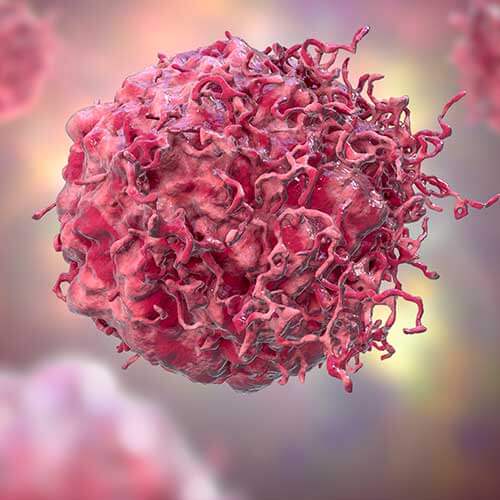 cancer cells