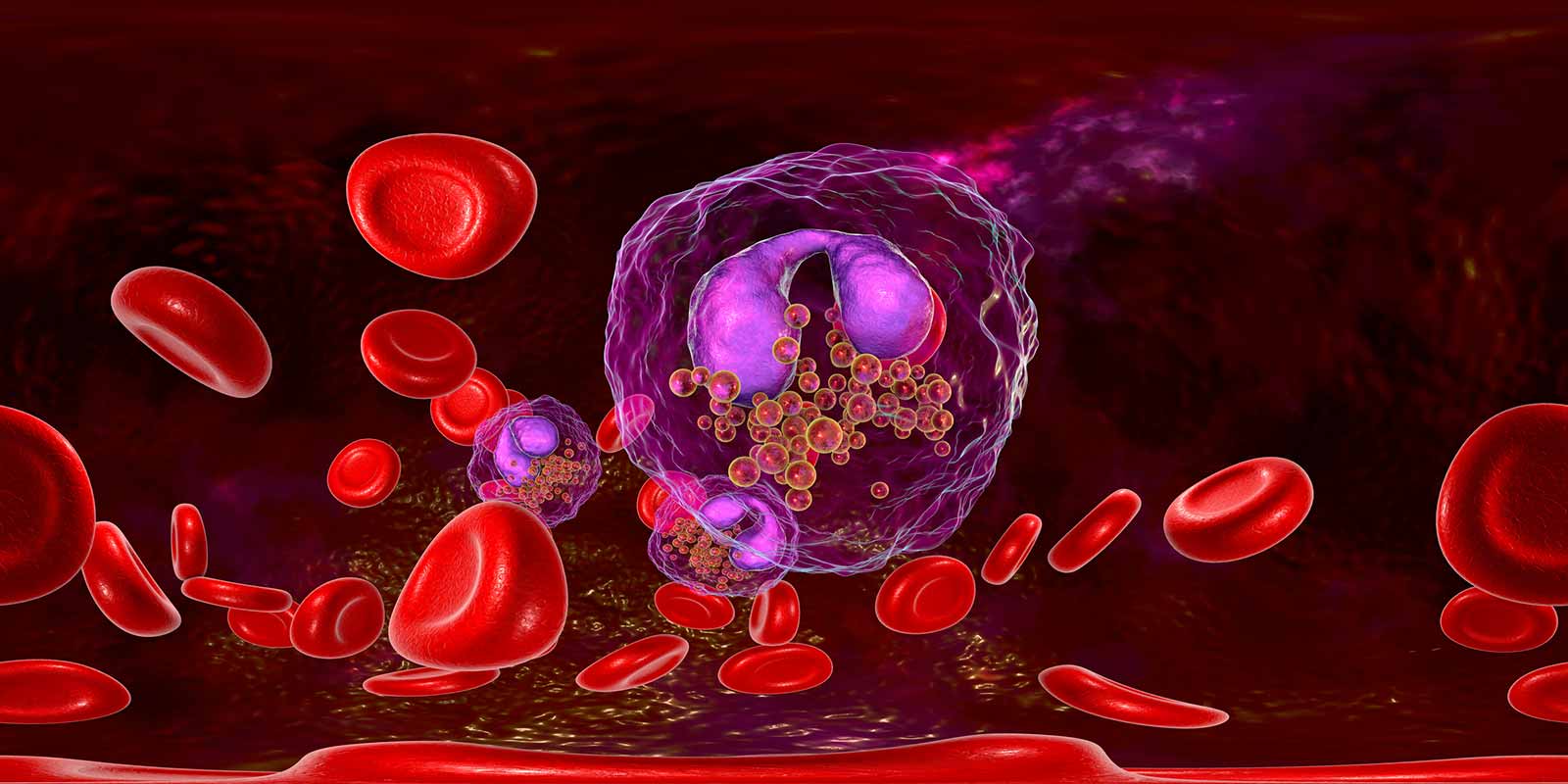 numerous eosinophils