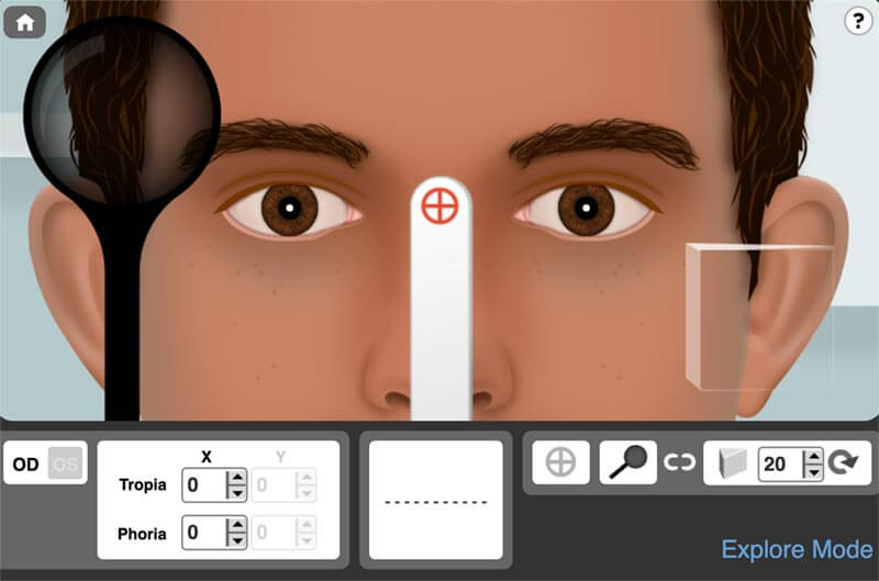 Retinoscopy Simulator