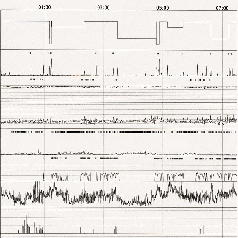 sleep study results