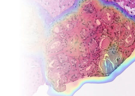 AI biomarkers