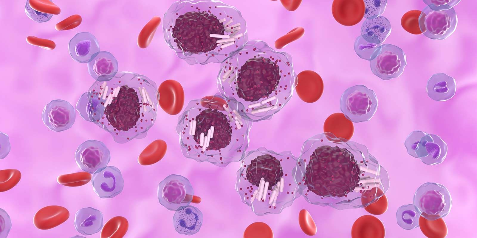 leukemia cells