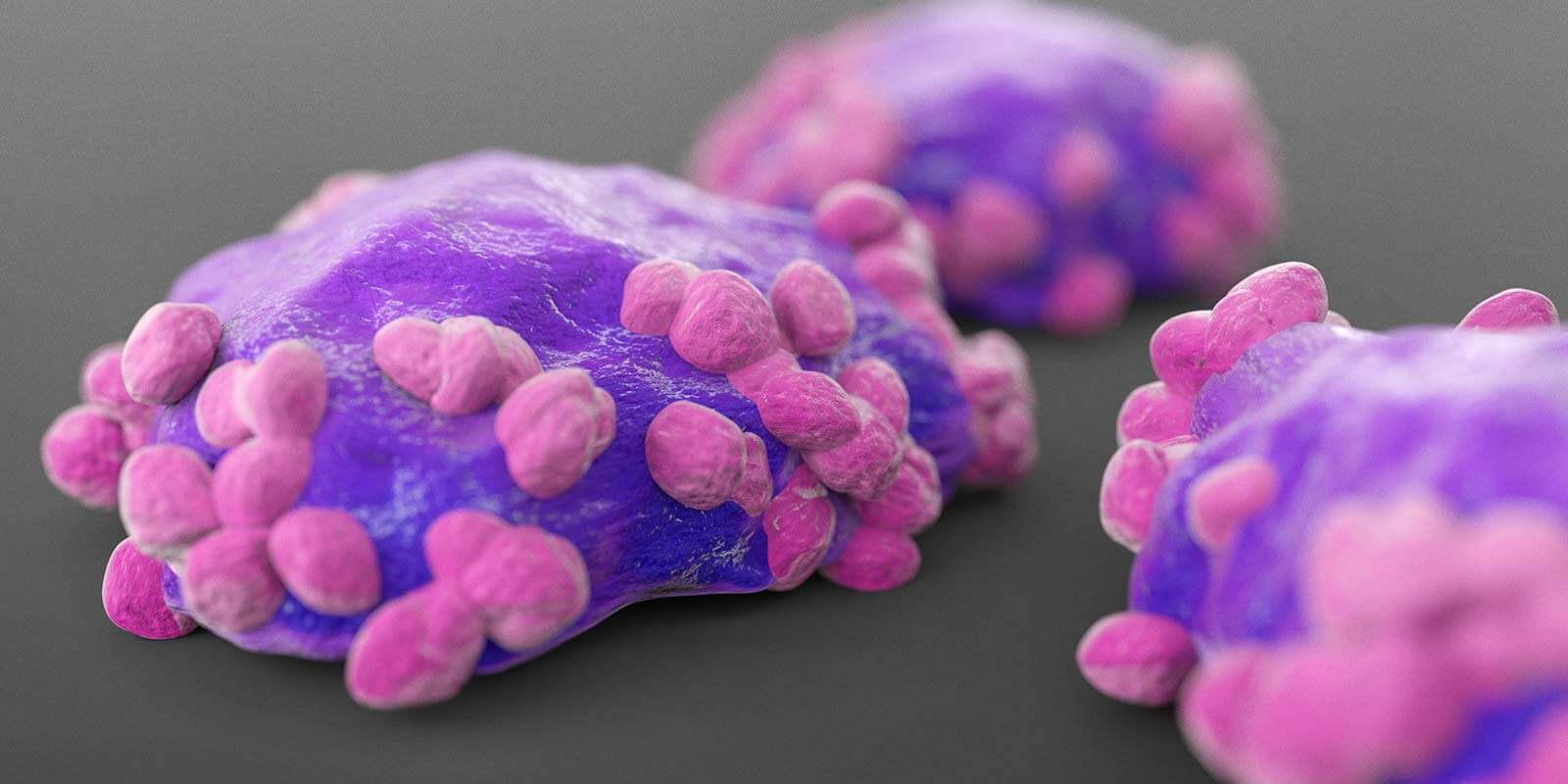 lymphoma cells