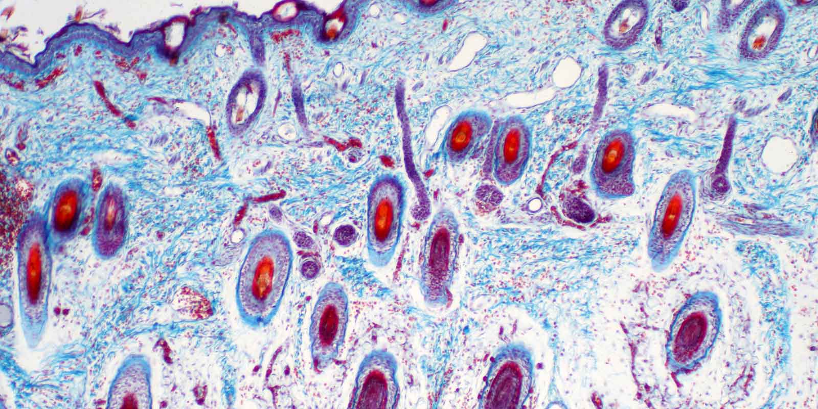 skin cells