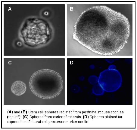 Hair Cell Regeneration
