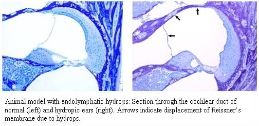 Molecular Otology Research